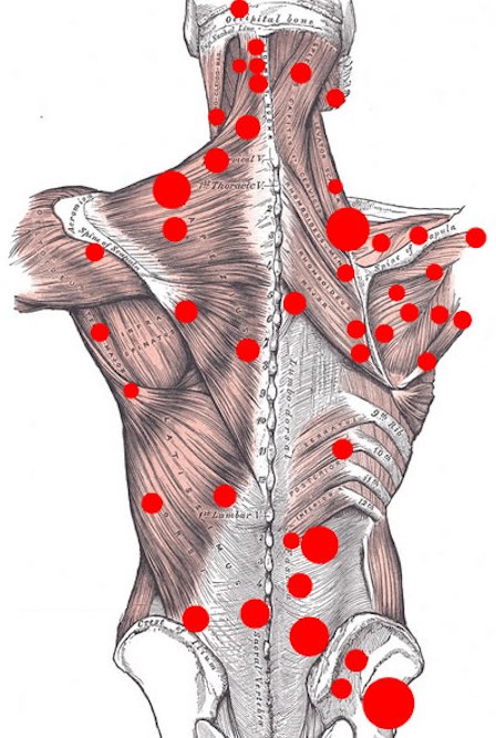 Urut Myofascial - apa itu, belajar mengurut wajah, badan, belakang. Foto, pelajaran video oleh Shubina