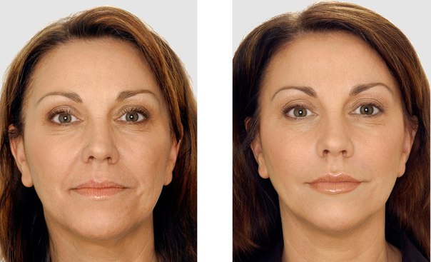 Revitonics - بناء الوجه ، جمباز الوجه. تمرين ، لياقة بدنية مضادة للتجاعيد ، لمرونة الجلد وعضلات الرقبة والوجه