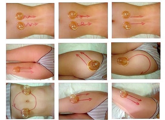 Massage chống cellulite tại nhà. Cách làm để giảm béo bụng, chân, mông và các bộ phận khác trên cơ thể. Hướng dẫn từng bước với ảnh