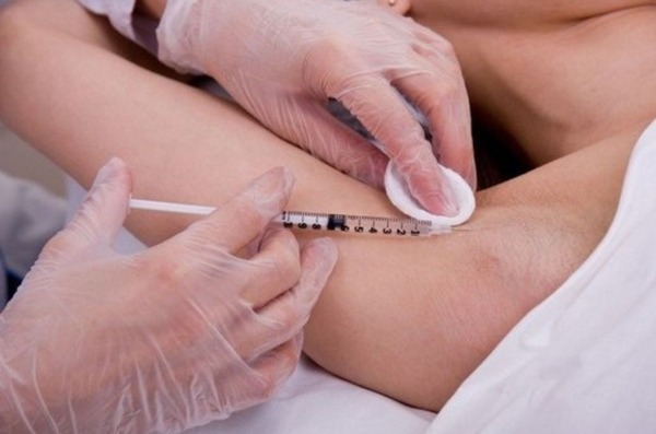 Nguyên nhân và cách điều trị chứng ra mồ hôi nách nhiều ở phụ nữ. Làm thế nào để loại bỏ mồ hôi bằng các biện pháp dân gian