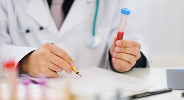 هرمون TSH - ما هو ، معدل هرمون الغدة الدرقية عند النساء ، علاج المستويات المنخفضة والمرتفعة