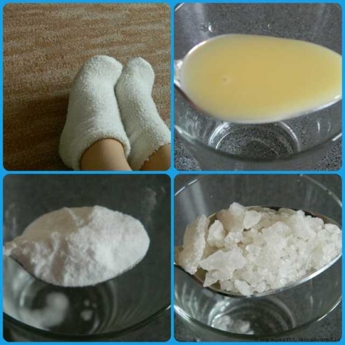 Cách loại bỏ da sần sùi ở gót chân nhanh chóng và hiệu quả tại nhà