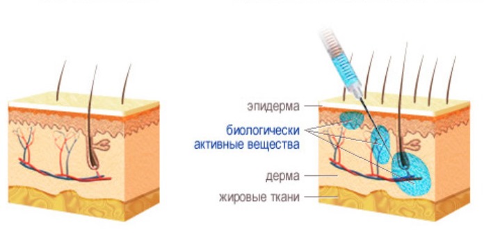 الميزوثيرابي للشعر - ما هو في التجميل ، كيف يتم ذلك ، ما هي الأدوية المستخدمة. الصور والاستعراضات