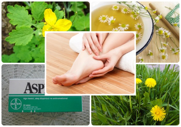 Vết chai ở chân - cách điều trị tại nhà bằng các biện pháp dân gian, thuốc mỡ, kem bôi, thạch cao