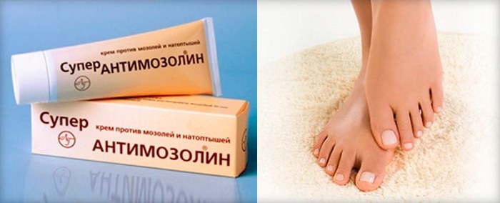 Vết chai ở chân - cách điều trị tại nhà bằng các biện pháp dân gian, thuốc mỡ, kem bôi, thạch cao