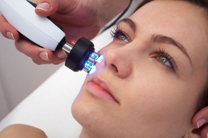 Oval facelift - mengangkat, krim kulit, benang, topeng, latihan di rumah. Gambar