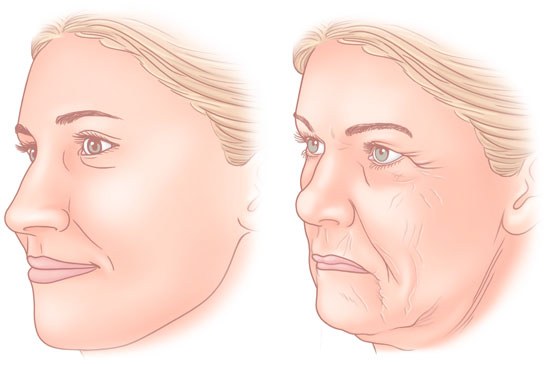 Oval facelift - mengangkat, krim kulit, benang, topeng, latihan di rumah. Gambar