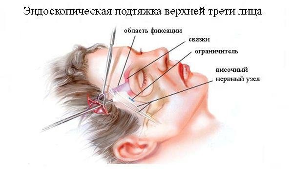 Oval facelift - mengangkat, krim kulit, benang, topeng, latihan di rumah. Gambar