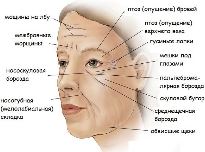 Oval facelift - mengangkat, krim kulit, benang, topeng, latihan di rumah. Gambar