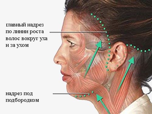 Oval facelift - mengangkat, krim kulit, benang, topeng, latihan di rumah. Gambar