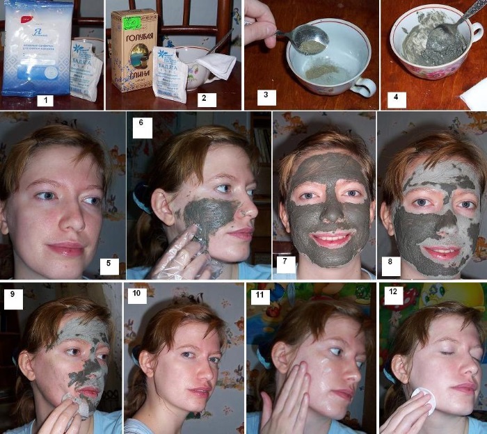 Cicatrizes no rosto após acne - como se livrar de: cremes, pomadas, produtos farmacêuticos, máscaras, métodos cosméticos e médicos