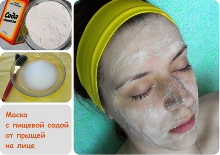 Cicatrizes no rosto após acne - como se livrar de: cremes, pomadas, produtos farmacêuticos, máscaras, métodos cosméticos e médicos