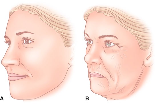 Nâng cơ SMAS - làm sạch mặt bằng sóng siêu âm. Đặc điểm của quy trình, chỉ định, chống chỉ định, hiệu quả mong đợi, ảnh
