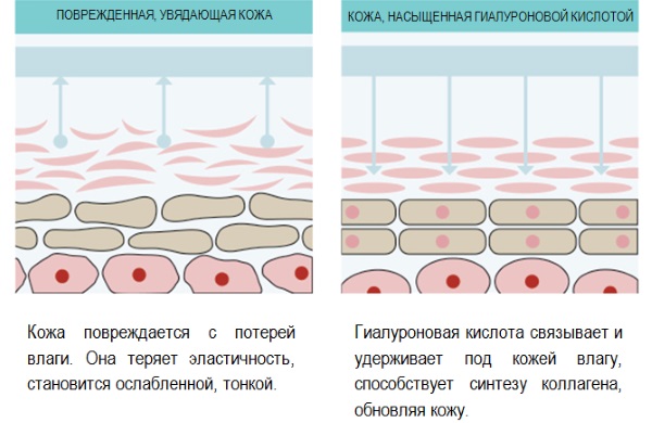 Top 10 loại kem có axit hyaluronic theo đánh giá của các chuyên gia thẩm mỹ cho làn da 40-50 tuổi