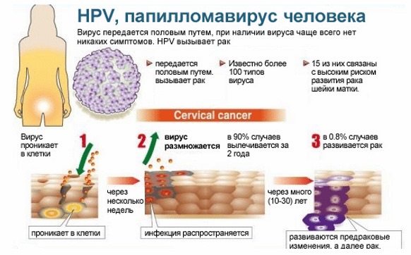 HPV ในผู้หญิง - มันคืออะไรอาการประเภทการแพร่เชื้อการรักษา human papillomavirus ทางนรีเวชวิทยา
