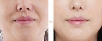 Cobrando pelo rosto. Facelift de Galina Dubinina. Exercícios do curso de ginástica para levantamento do contorno facial. Video aulas