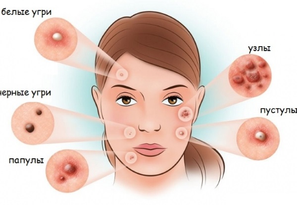 Liệu pháp quang động trong thẩm mỹ. Quy trình, chỉ định và hiệu quả ra sao
