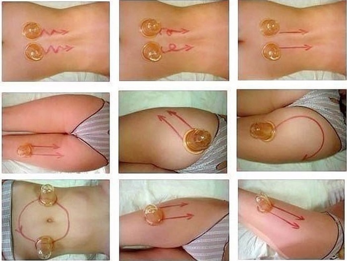 Làm thế nào để nhanh chóng loại bỏ cellulite ở dưới và chân: quấn, xoa bóp, tập thể dục