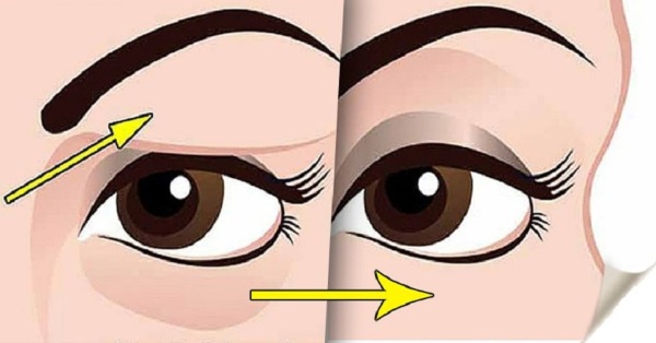 Como se livrar do século que se aproxima em casa. Métodos tradicionais, procedimentos cosméticos, cirurgia, cremes e pomadas