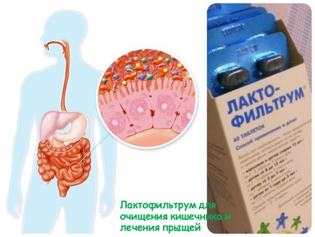 Lactofiltrum cho mụn trứng cá: nhận xét của bác sĩ da liễu với hình ảnh trước và sau. Hướng dẫn sử dụng, chất tương tự, giá cả