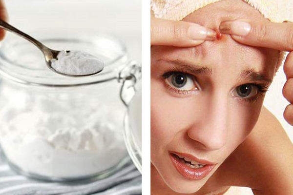 Mặt nạ với baking soda trị nếp nhăn, mụn trứng cá, mụn đầu đen, đồi mồi. Công thức nấu ăn và sử dụng tại nhà