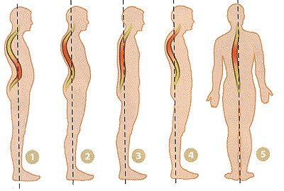 Máy mát xa lưng và cổ, cơ thể, bị hoại tử xương. Làm thế nào để chọn để sử dụng trong nhà