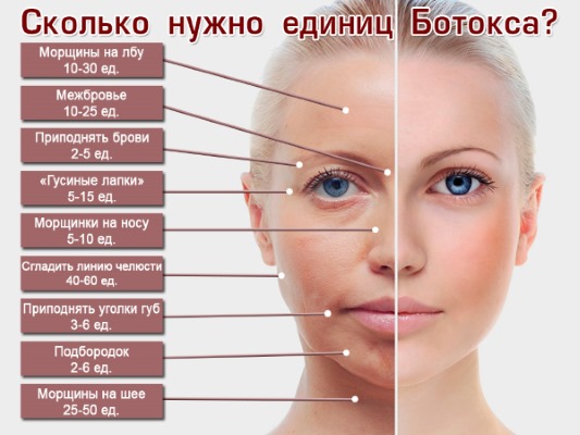 Giải phẫu cơ mặt người trong ngành thẩm mỹ tiêm botox. Lược đồ có mô tả và hình ảnh bằng tiếng Latinh và tiếng Nga