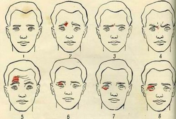 Giải phẫu cơ mặt người trong ngành thẩm mỹ tiêm botox. Lược đồ có mô tả và hình ảnh bằng tiếng Latinh và tiếng Nga