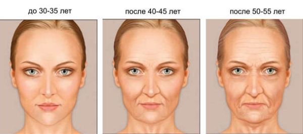 Giải phẫu cơ mặt người trong ngành thẩm mỹ tiêm botox. Lược đồ có mô tả và hình ảnh bằng tiếng Latinh và tiếng Nga