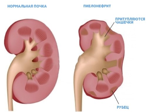 Отицање лица код жена. Узроци и лечење народним лековима, таблетама, маскама, препорученим производима, како ублажити отеченост ујутру