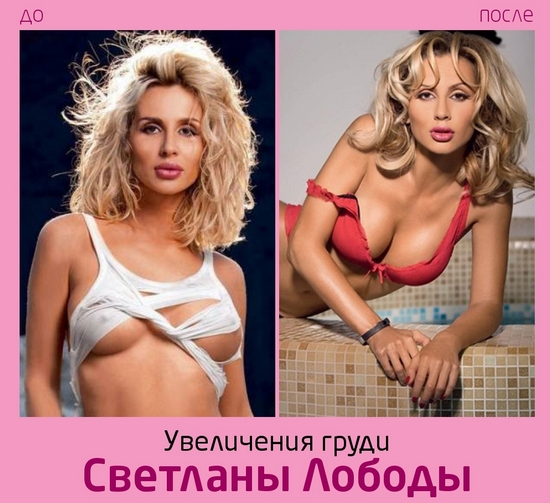 Светлана Лобода пре и после пластичне хирургије. Фотографија лица, носа, усана, груди. Биографија певача, старост, параметри облика, висина и тежина