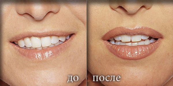 Tatu bibir dengan warna: warna semula jadi, 3D, miass, karamel, foto