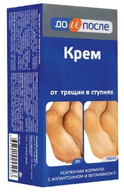 Nứt gót. Nguyên nhân và cách điều trị. Phương pháp dân gian, thuốc mỡ, kem, vitamin