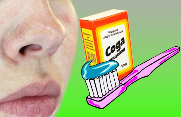 Cách bôi kem đánh răng trị mụn trên mặt. Công thức chuẩn bị và sử dụng, ảnh