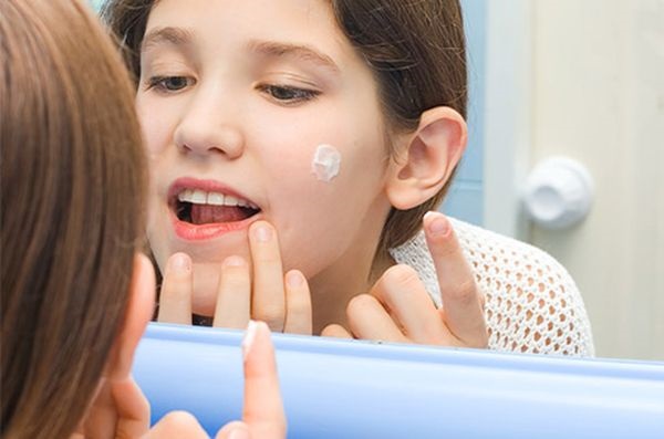 Cách bôi kem đánh răng trị mụn trên mặt. Công thức chuẩn bị và sử dụng, ảnh