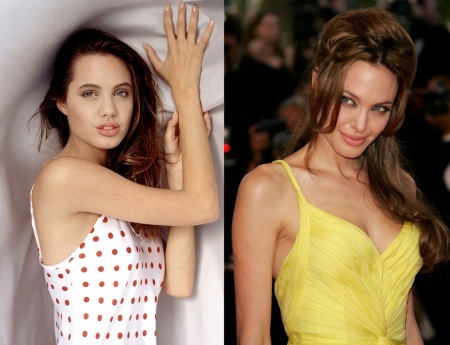 Angelina Jolie trước và sau khi phẫu thuật thẩm mỹ. Tuyển tập những bức ảnh của nữ diễn viên trước và sau khi phẫu thuật nâng mũi, nâng mũi plasma
