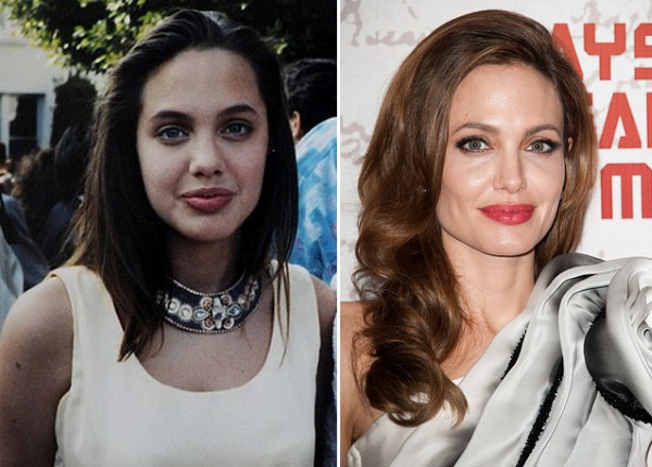 Angelina Jolie trước và sau khi phẫu thuật thẩm mỹ. Tuyển tập những bức ảnh của nữ diễn viên trước và sau khi phẫu thuật nâng mũi, nâng mũi plasma