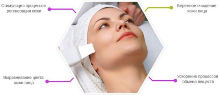 Dụng cụ làm sạch da mặt. Các loài, 5 loại tốt nhất để sử dụng tại nhà. Cách chọn cách sử dụng