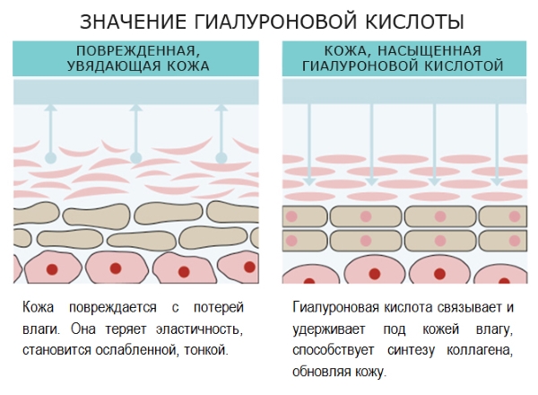 Tái tạo sức sống sinh học cho khuôn mặt là gì, nó khác gì với liệu pháp mesotherapy, chất làm đầy. Chỉ định, chống chỉ định, hậu quả. Một bức ảnh