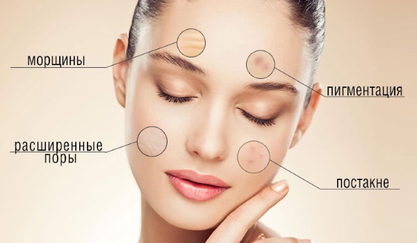 Ferul peel - nó là gì, nó được thực hiện như thế nào, axit, quy trình của quy trình Medderma, đánh giá, ảnh và kết quả