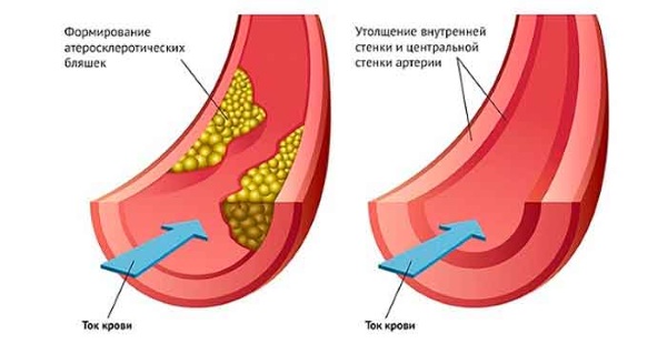 Ferul peel - nó là gì, nó được thực hiện như thế nào, axit, quy trình của quy trình Medderma, đánh giá, ảnh và kết quả