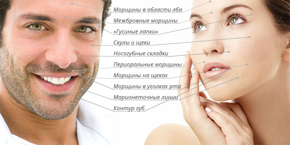 Mesoterapi pecahan muka - apakah itu, bagaimana ia dilakukan, keberkesanan parut, kesan regangan, beg di bawah mata, harga kursus, gambar sebelum dan selepas, ulasan