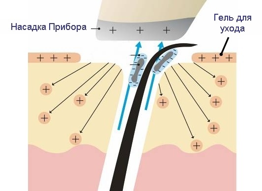 Mạ điện trong thẩm mỹ - nó là gì, quy trình được thực hiện như thế nào cho vùng da quanh mắt, mặt và cơ thể, ưu và nhược điểm, lợi ích. Thiết bị sử dụng trong gia đình. Một bức ảnh