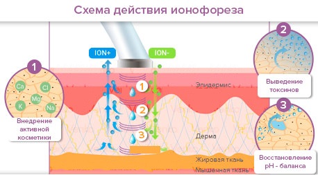 Mạ điện trong thẩm mỹ - nó là gì, quy trình được thực hiện như thế nào cho vùng da quanh mắt, mặt và cơ thể, ưu và nhược điểm, lợi ích. Thiết bị sử dụng trong gia đình. Một bức ảnh