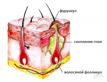 Mạ điện trong thẩm mỹ - nó là gì, quy trình được thực hiện như thế nào cho vùng da quanh mắt, mặt và cơ thể, ưu và nhược điểm, lợi ích. Thiết bị sử dụng trong gia đình. Một bức ảnh