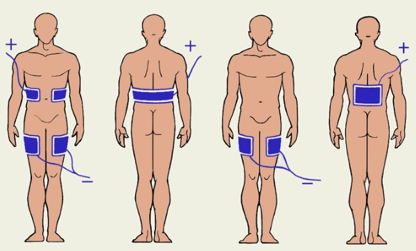 Mạ điện trong thẩm mỹ - nó là gì, quy trình được thực hiện như thế nào cho vùng da quanh mắt, mặt và cơ thể, ưu và nhược điểm, lợi ích. Thiết bị sử dụng trong gia đình. Một bức ảnh