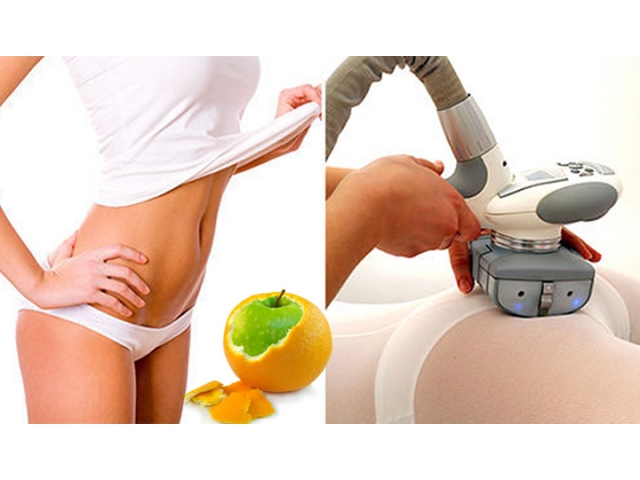 Cách giảm khối lượng hông, bỏ tai và bơm mông lên. Chương trình giảm cân trong một tuần, tập thể dục trong phòng tập thể dục và tại nhà