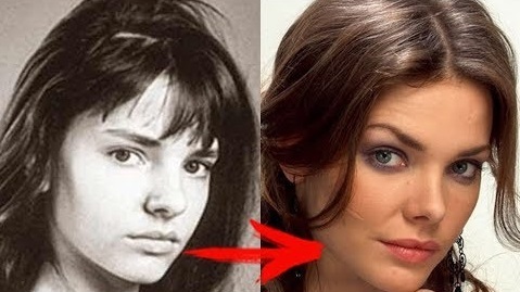 Elizaveta Boyarskaya. Tiểu sử, đời tư, ảnh thời thơ ấu và niên thiếu, phẫu thuật thẩm mỹ mặt, môi, mũi, ảnh trước và sau