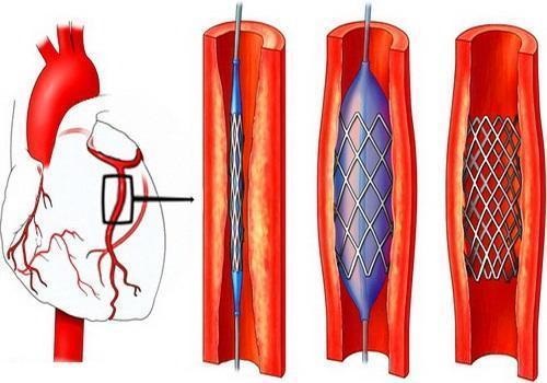 Mesoscooter cho khuôn mặt: cái nào để chọn, cách sử dụng nó tại nhà, hướng dẫn, hình ảnh trước và sau