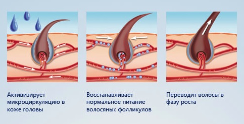 Minoxidil cho tóc: cách hoạt động, hiệu quả, trước và sau ảnh, đánh giá. Cách áp dụng cho phụ nữ và nam giới, tác dụng phụ, tác hại có thể xảy ra. Giá cả và đánh giá